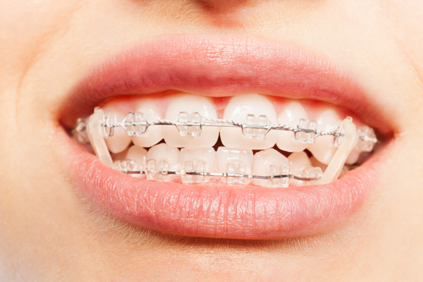 Common Treatments From An Orthodontist Near Me